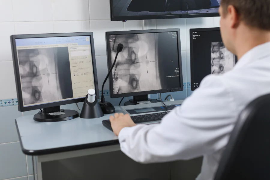 Medic analizând imagini CT și RMN utilizate în diagnosticul cancerului hepatic