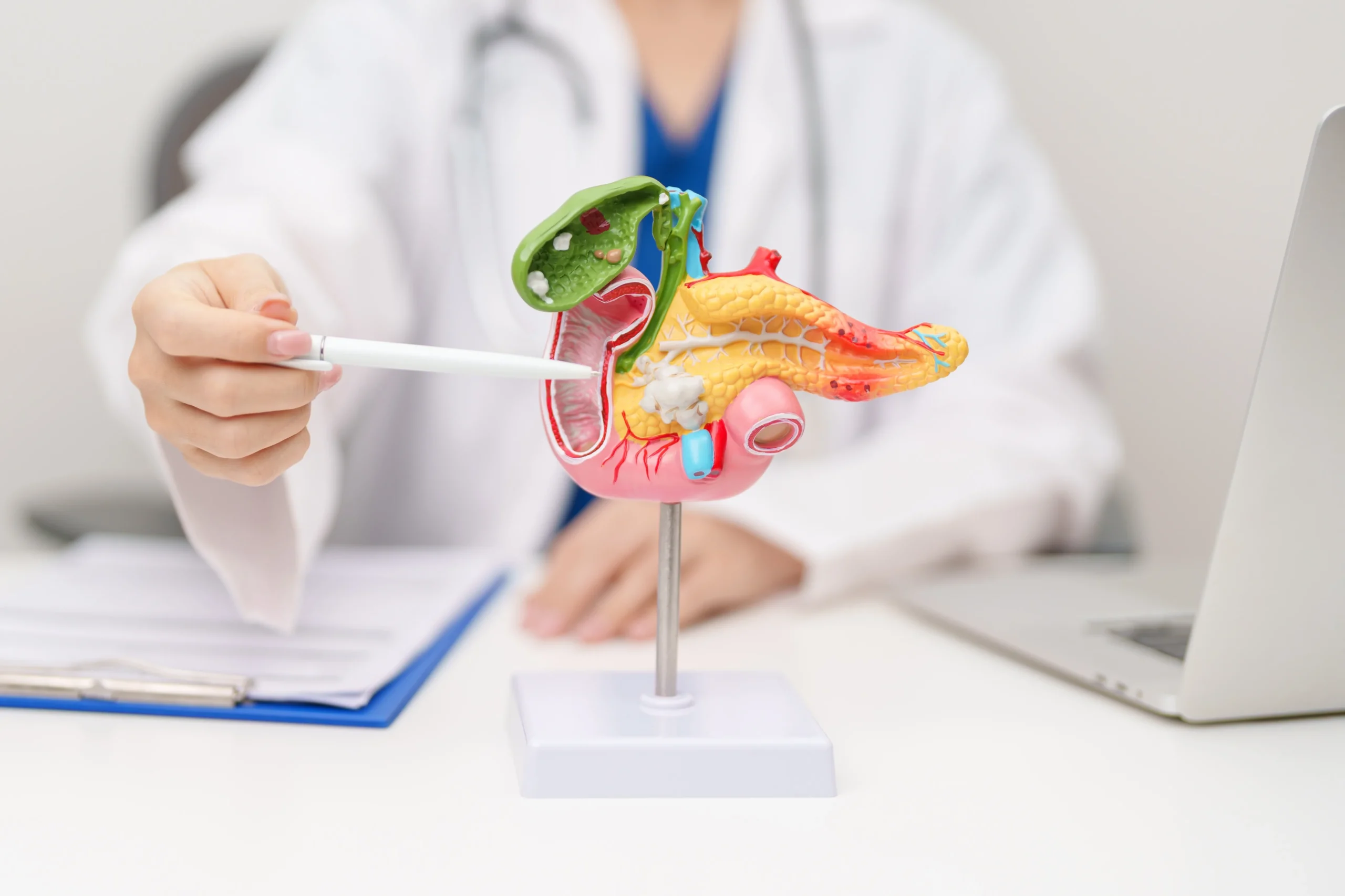 Cum îți poți reduce riscul de cancer pancreatic