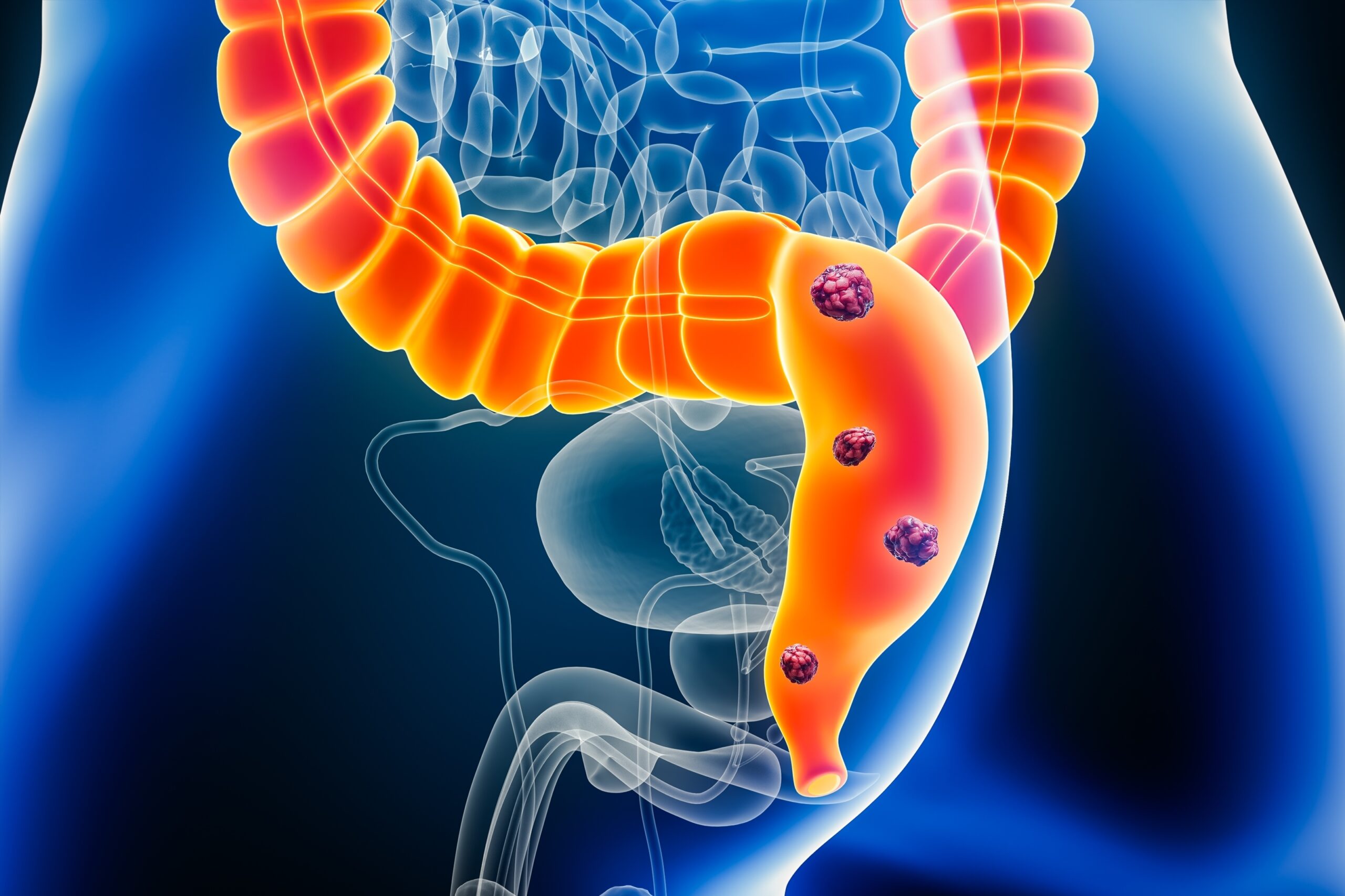Patologie colorectală și proctologie